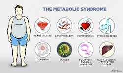 Metabolic Syndrome