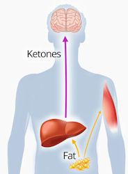 Ketosis