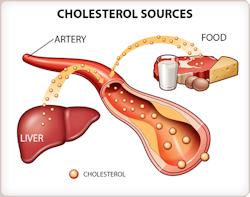 Cholesterol Sources